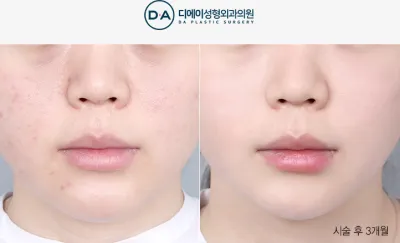 Before & After