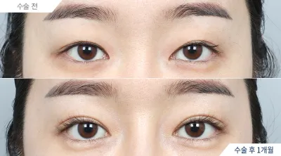 Before & After