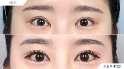 Before & After