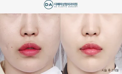 Before & After