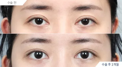 Before & After