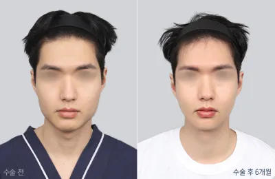 Before & After