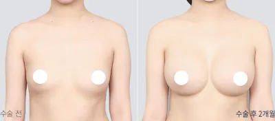 Before & After