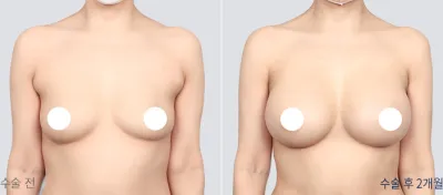 Before & After