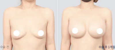Before & After