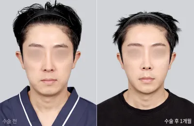 Before & After