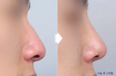 Before & After