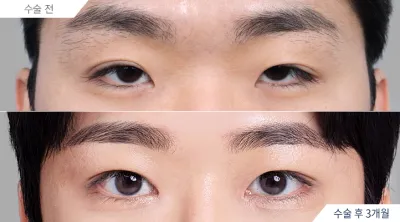 Before & After