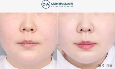 Before & After