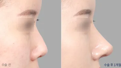 Before & After