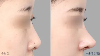 Before & After