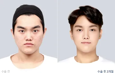 Before & After