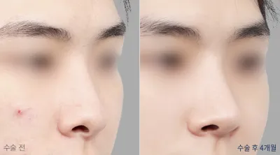Before & After