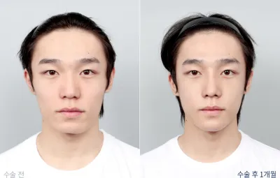 Before & After