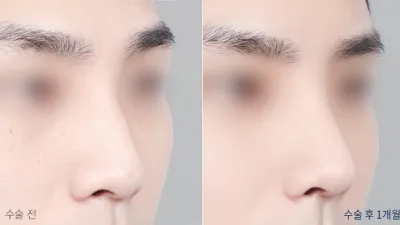 Before & After