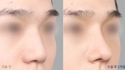 Before & After