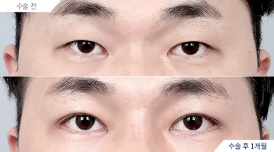 Before & After