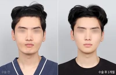 Before & After