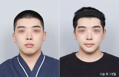 Before & After