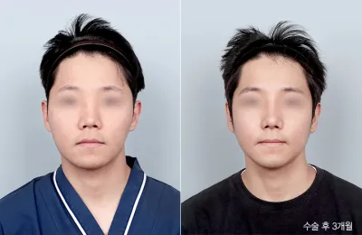 Before & After