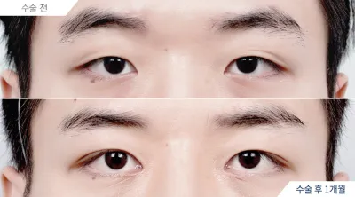 Before & After