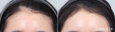 Before & After