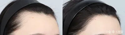 Before & After