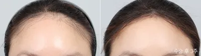 Before & After