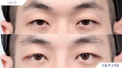 Before & After