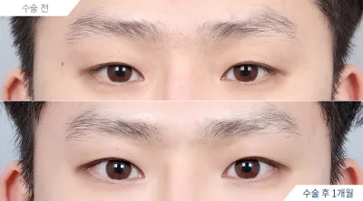 Before & After