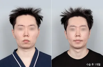 Before & After
