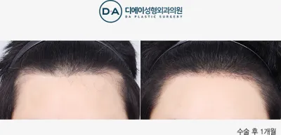 Before & After