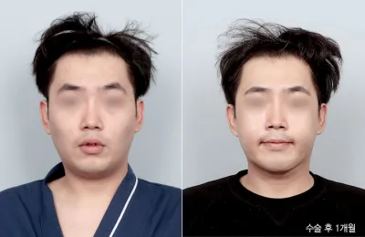 Before & After