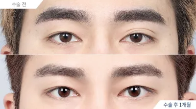 Before & After