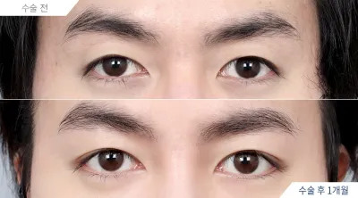 Before & After