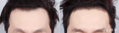 Before & After