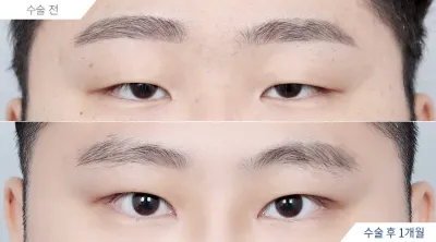 Before & After