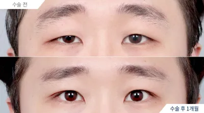 Before & After