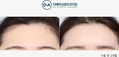 Before & After