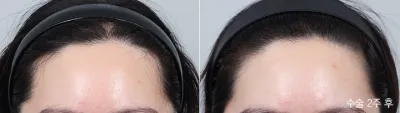Before & After