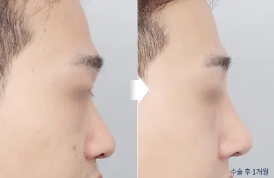 Before & After