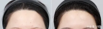 Before & After