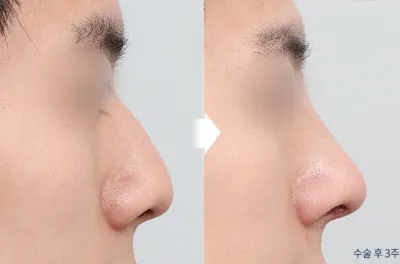 Before & After
