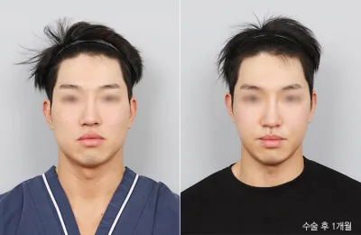 Before & After