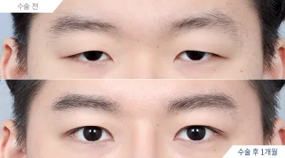 Before & After
