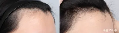 Before & After