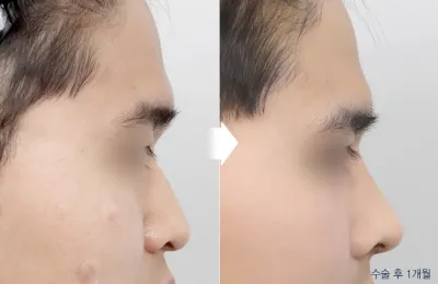Before & After