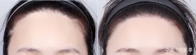 Before & After