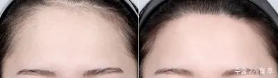 Before & After