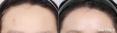 Before & After